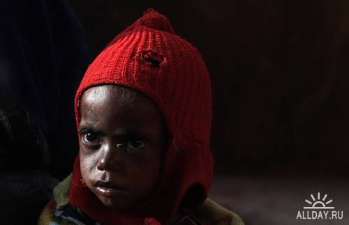 Детский голод в Индии