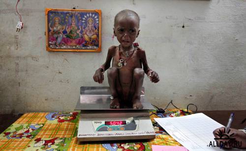 Детский голод в Индии